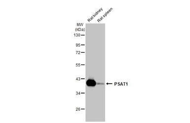 Anti-PSAT1 antibody [HL2270] used in Western Blot (WB). GTX638322