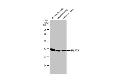 Anti-PSAT1 antibody [HL2270] used in Western Blot (WB). GTX638322