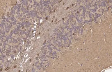 Anti-PSAT1 antibody [HL2270] used in IHC (Paraffin sections) (IHC-P). GTX638322