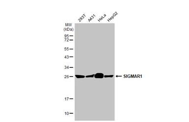 Anti-SIGMAR1 antibody [HL2274] used in Western Blot (WB). GTX638326