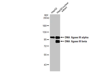 Anti-DNA ligase III antibody [HL2280] used in Western Blot (WB). GTX638333