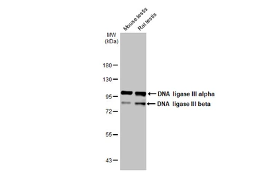Anti-DNA ligase III antibody [HL2280] used in Western Blot (WB). GTX638333