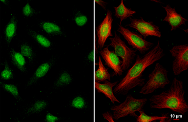 Anti-DNA ligase III antibody [HL2280] used in Immunocytochemistry/ Immunofluorescence (ICC/IF). GTX638333