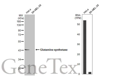 Anti-Glutamine synthetase antibody [HL2283] used in Western Blot (WB). GTX638336