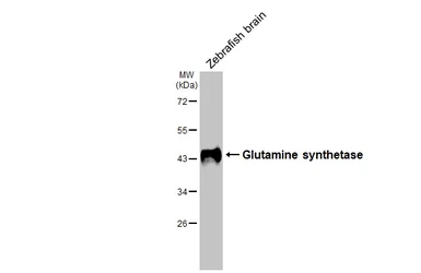 Anti-Glutamine synthetase antibody [HL2283] used in Western Blot (WB). GTX638336