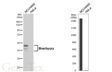 Anti-Brachyury antibody [HL2285] used in Western Blot (WB). GTX638338