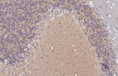 Anti-VPS34 antibody [HL2305] used in IHC (Paraffin sections) (IHC-P). GTX638372