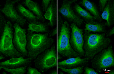Anti-VPS34 antibody [HL2305] used in Immunocytochemistry/ Immunofluorescence (ICC/IF). GTX638372