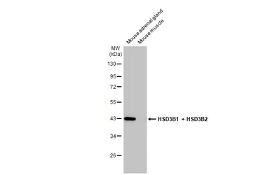 Anti-HSD3B1 + HSD3B2 antibody [HL2307] used in Western Blot (WB). GTX638470