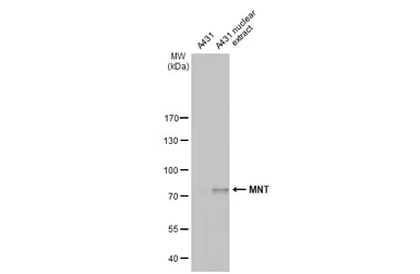 Anti-MNT antibody [HL2309] used in Western Blot (WB). GTX638472