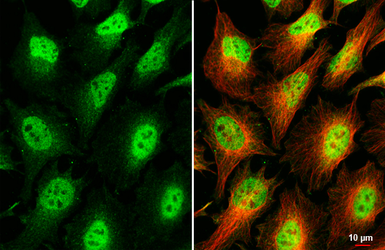 Anti-MNT antibody [HL2309] used in Immunocytochemistry/ Immunofluorescence (ICC/IF). GTX638472