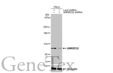 Anti-ANKRD32 antibody [HL2311] used in Western Blot (WB). GTX638474