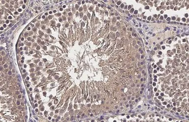 Anti-CP110 antibody [HL2312] used in IHC (Paraffin sections) (IHC-P). GTX638475
