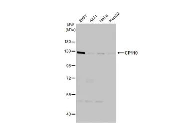 Anti-CP110 antibody [HL2312] used in Western Blot (WB). GTX638475