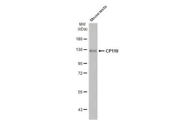 Anti-CP110 antibody [HL2312] used in Western Blot (WB). GTX638475