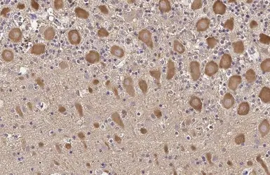 Anti-TLR3 antibody [HL2314] used in IHC (Paraffin sections) (IHC-P). GTX638477