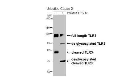Anti-TLR3 antibody [HL2314] used in Western Blot (WB). GTX638477