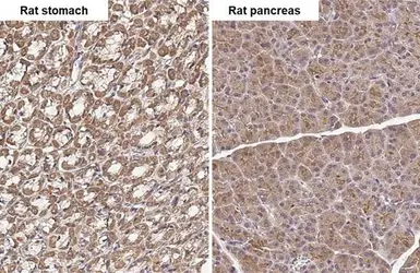 Anti-TLR3 antibody [HL2314] used in IHC (Paraffin sections) (IHC-P). GTX638477