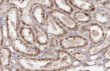 Anti-ST6GAL1 antibody [HL2318] used in IHC (Paraffin sections) (IHC-P). GTX638481