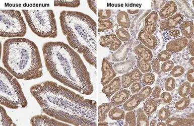 Anti-ST6GAL1 antibody [HL2318] used in IHC (Paraffin sections) (IHC-P). GTX638481