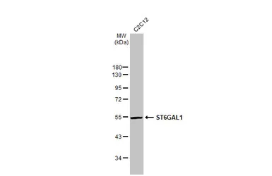 Anti-ST6GAL1 antibody [HL2318] used in Western Blot (WB). GTX638481