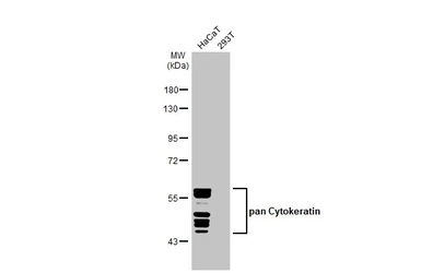 Anti-pan Cytokeratin antibody [HL2321] used in Western Blot (WB). GTX638484