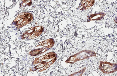 Anti-pan Cytokeratin antibody [HL2321] used in IHC (Paraffin sections) (IHC-P). GTX638484