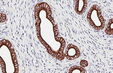 Anti-pan Cytokeratin antibody [HL2321] used in IHC (Paraffin sections) (IHC-P). GTX638484