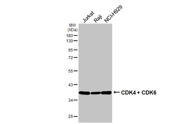 Anti-CDK4 + CDK6 antibody [HL2323] used in Western Blot (WB). GTX638486