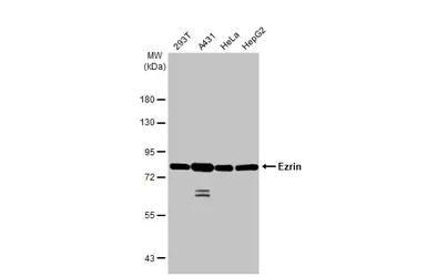 Anti-Ezrin antibody [HL2327] used in Western Blot (WB). GTX638490