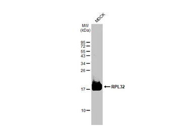 Anti-RPL32 antibody [HL2329] used in Western Blot (WB). GTX638492