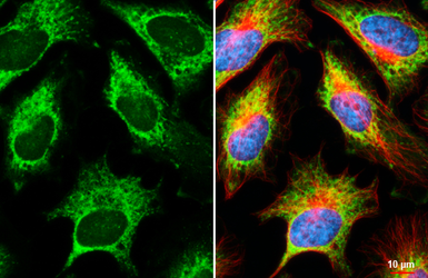 Anti-RPL32 antibody [HL2329] used in Immunocytochemistry/ Immunofluorescence (ICC/IF). GTX638492