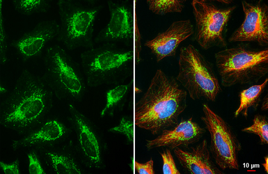 Anti-RNase L antibody [HL2340] used in Immunocytochemistry/ Immunofluorescence (ICC/IF). GTX638543