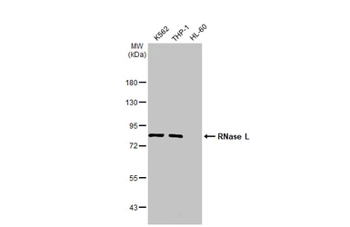 Anti-RNase L antibody [HL2341] used in Western Blot (WB). GTX638544