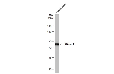 Anti-RNase L antibody [HL2341] used in Western Blot (WB). GTX638544