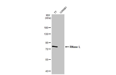 Anti-RNase L antibody [HL2341] used in Western Blot (WB). GTX638544