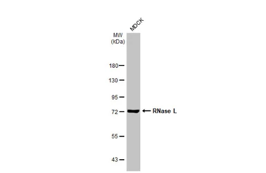 Anti-RNase L antibody [HL2341] used in Western Blot (WB). GTX638544