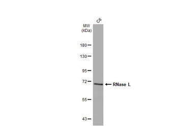 Anti-RNase L antibody [HL2341] used in Western Blot (WB). GTX638544