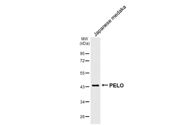 Anti-PELO antibody [HL2345] used in Western Blot (WB). GTX638548