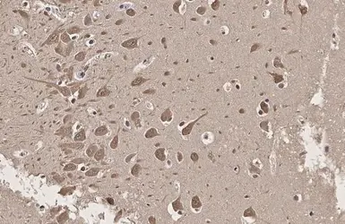 Anti-SERCA2 ATPase antibody [HL2352] used in IHC (Paraffin sections) (IHC-P). GTX638555