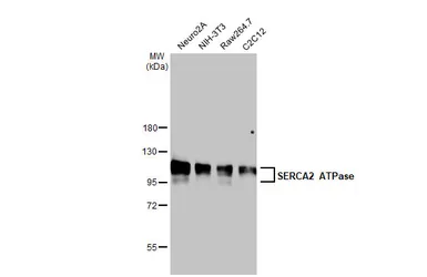 Anti-SERCA2 ATPase antibody [HL2352] used in Western Blot (WB). GTX638555