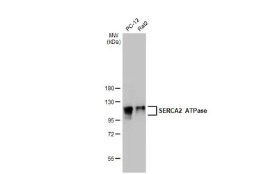Anti-SERCA2 ATPase antibody [HL2352] used in Western Blot (WB). GTX638555