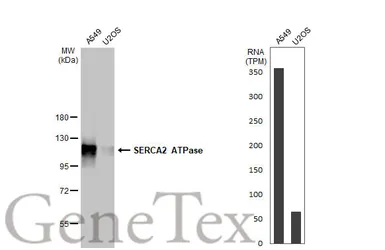 Anti-SERCA2 ATPase antibody [HL2352] used in Western Blot (WB). GTX638555