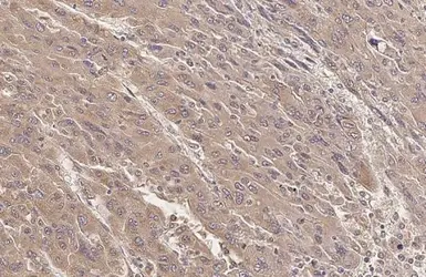 Anti-SERCA2 ATPase antibody [HL2352] used in IHC (Paraffin sections) (IHC-P). GTX638555