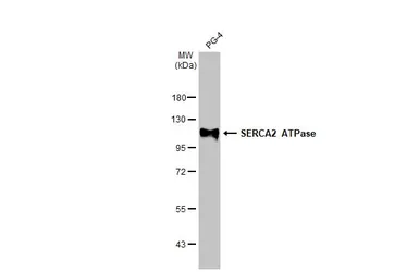 Anti-SERCA2 ATPase antibody [HL2352] used in Western Blot (WB). GTX638555