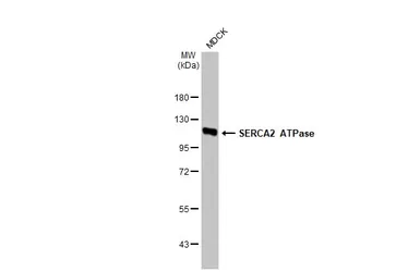 Anti-SERCA2 ATPase antibody [HL2352] used in Western Blot (WB). GTX638555