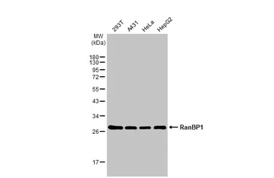 Anti-RanBP1 antibody [HL2358] used in Western Blot (WB). GTX638564