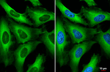 Anti-RanBP1 antibody [HL2358] used in Immunocytochemistry/ Immunofluorescence (ICC/IF). GTX638564
