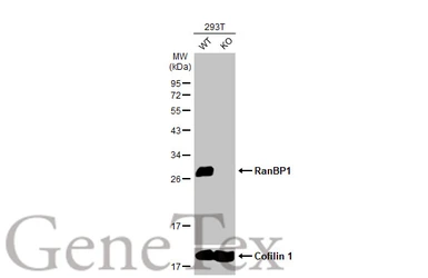 Anti-RanBP1 antibody [HL2358] used in Western Blot (WB). GTX638564