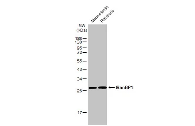 Anti-RanBP1 antibody [HL2358] used in Western Blot (WB). GTX638564